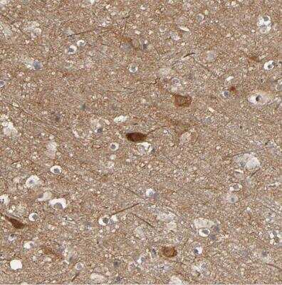 Immunohistochemistry-Paraffin: SGSM1 Antibody [NBP1-93564] - Staining of human cerebral cortex shows moderate to strong cytoplasmic positivity in neurons.