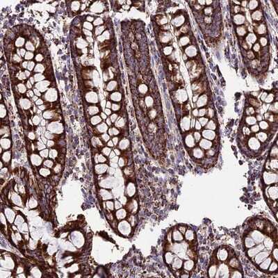 Immunohistochemistry-Paraffin: SGTB Antibody [NBP1-92385] - Staining of human colon shows strong cytoplasmic positivity in glandular cells.