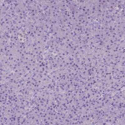 Immunohistochemistry-Paraffin SGTB Antibody