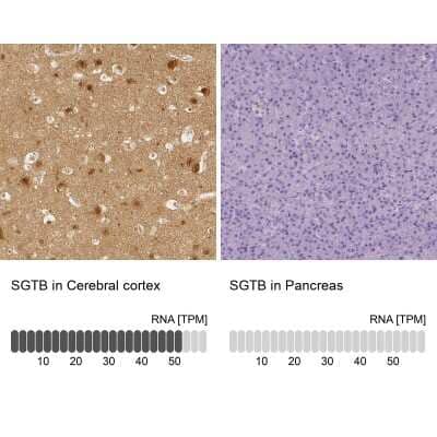 Immunohistochemistry-Paraffin SGTB Antibody