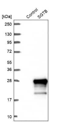Western Blot: SGTB Antibody [NBP2-38998] - Analysis in control (vector only transfected HEK293T lysate) and SGTB over-expression lysate (Co-expressed with a C-terminal myc-DDK tag (3.1 kDa) in mammalian HEK293T cells).