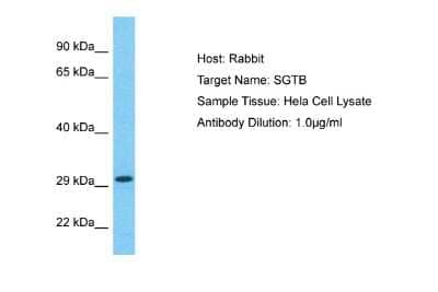 Western Blot: SGTB Antibody [NBP2-88258] - Host: Rabbit. Target Name: SGTB. Sample Type: Hela Whole Cell lysates. Antibody Dilution: 1.0ug/ml