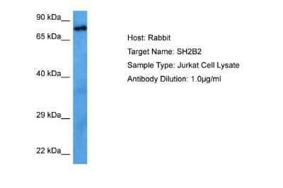 Western Blot: SH2B2 Antibody [NBP2-85716] - Host: Rabbit. Target Name: SH2B2. Sample Tissue: Human Jurkat Whole Cell lysates. Antibody Dilution: 1ug/ml