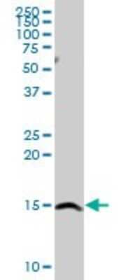 Western Blot: SH2D1A Antibody [H00004068-D01P] - Analysis of SH2D1A expression in Jurkat.