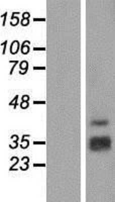 Western Blot: SH2D1B Overexpression Lysate (Adult Normal) [NBP2-05818] Left-Empty vector transfected control cell lysate (HEK293 cell lysate); Right -Over-expression Lysate for SH2D1B.
