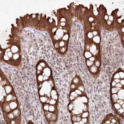 Immunohistochemistry-Paraffin: SH2D3A Antibody [NBP1-82525] - Staining of human colon shows strong cytoplasmic positivity in glandular cells.