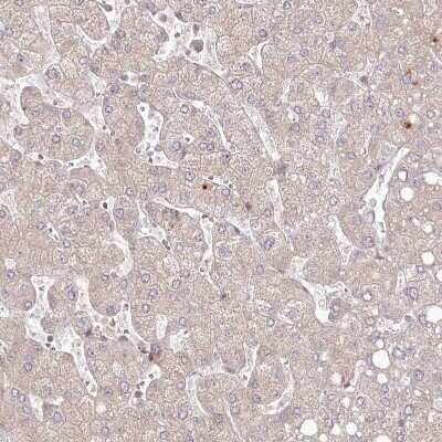 Immunohistochemistry-Paraffin: SH2D3A Antibody [NBP1-82525] - Staining of human liver shows only very weak cytoplasmic positivity in hepatocytes.