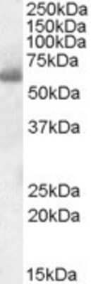 Western Blot: SH2D3A Antibody [NBP1-36986] - (0.1ug/ml) Analysis of Human Tonsil lysate (35ug protein in RIPA buffer). Primary incubation was 1 hour. Detected by chemiluminescence.