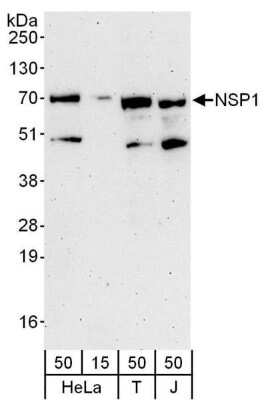 Western Blot: SH2D3A Antibody [NBP1-78202] - Whole cell lysate from HeLa (15 and 15 ug), 293T (T; 50 ug) and Jurkat (J; 50 ug) cells. Antibody used at 0.04 ug/ml.