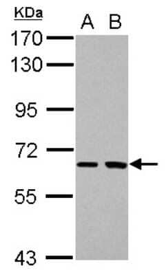 Western Blot: SH2D3A Antibody [NBP2-20340] - Sample (30 ug of whole cell lysate) A: H1299 B: HCT116 7. 5% SDS PAGE gel, diluted at 1:1000.