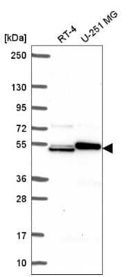 Western Blot: SH2D3A Antibody [NBP2-57054] - Western blot analysis in human cell line RT-4 and human cell line U-251 MG.