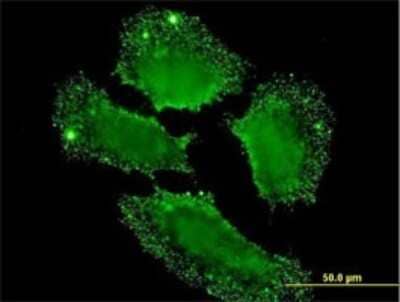 Immunocytochemistry/Immunofluorescence: SH2D3C Antibody (1B6) [H00010044-M04] - Analysis of monoclonal antibody to SH2D3C on HeLa cell. Antibody concentration 10 ug/ml