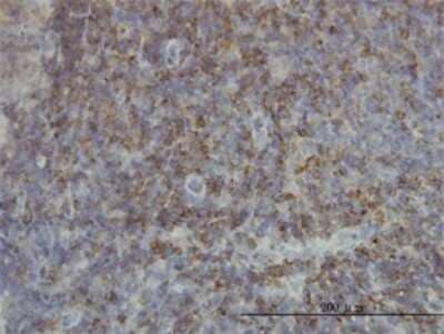 Immunohistochemistry-Paraffin: SH2D3C Antibody (3B2) [H00010044-M01] - Analysis of monoclonal antibody to SH2D3C on formalin-fixed paraffin-embedded human lymph node. Antibody concentration 3 ug/ml.