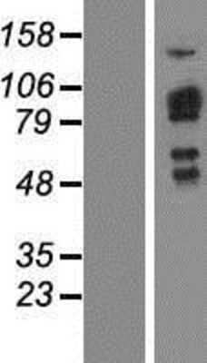 Western Blot SH2D3C Overexpression Lysate