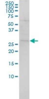 Western Blot: SH3BGR Antibody (3B7) [H00006450-M01] - SH3BGR monoclonal antibody (M01), clone 3B7 Analysis of SH3BGR expression in Hela.