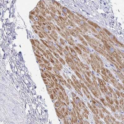 Immunohistochemistry-Paraffin SH3BGR Antibody