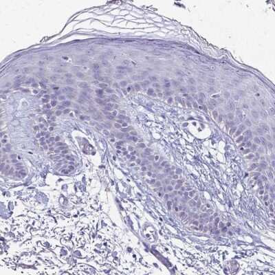 Immunohistochemistry-Paraffin SH3BGR Antibody