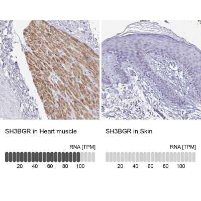 Immunohistochemistry-Paraffin SH3BGR Antibody