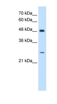 Western Blot SH3BGR Antibody