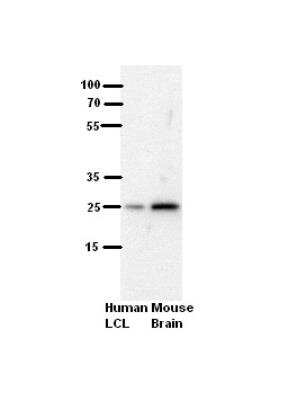 Western Blot: SH3BGR Antibody [NBP1-80550] - Blocking: 5% Milk Positive Control: human LCL and mouse brains
