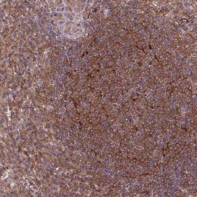 Immunohistochemistry-Paraffin SH3BGRL Antibody