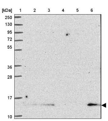 Western Blot SH3BGRL Antibody