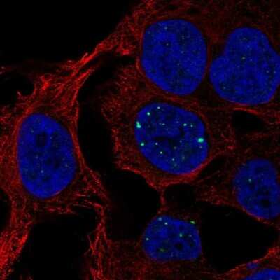 <b>Orthogonal Strategies Validation. </b>Immunocytochemistry/Immunofluorescence: SH3BGRL3 Antibody [NBP2-56311] - Staining of human cell line SK-MEL-30 shows localization to nuclear bodies.