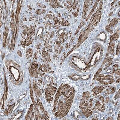 Immunohistochemistry-Paraffin SH3BGRL3 Antibody