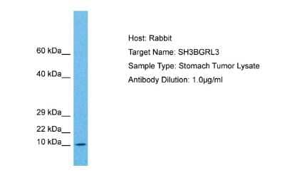 Western Blot: SH3BGRL3 Antibody [NBP2-85721] - Host: Rabbit. Target Name: SH3BGRL3. Sample Tissue: Human Stomach Tumor lysates. Antibody Dilution: 1ug/ml