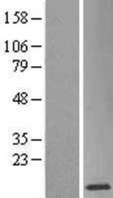 Western Blot: SH3BGRL3 Overexpression Lysate (Adult Normal) [NBL1-15925] Left-Empty vector transfected control cell lysate (HEK293 cell lysate); Right -Over-expression Lysate for SH3BGRL3.