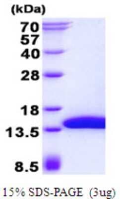 SDS-Page: SH3BGRL3 Protein [NBP2-23466]