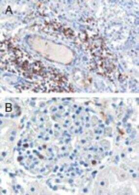 Immunohistochemistry-Paraffin: SH3BP1 Antibody [NB100-1398] - NB100-1398 (0.3ug/ml) staining of paraffin embedded Human Kidnay. Cytoplasmic staining of lymphocytes A) in the interstitial parenchyma of the kidney. B) in a glomerulus of the kidney. Microwaved antigen retrieval with citrate buffer pH 6, HRP-staining.