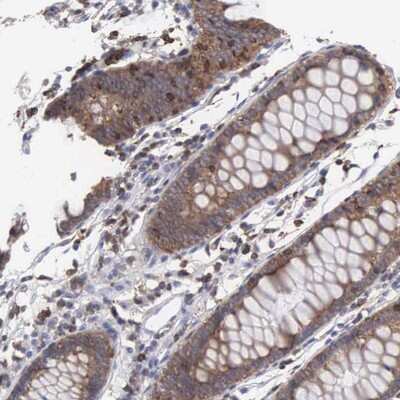 Immunohistochemistry-Paraffin: SH3BP1 Antibody [NBP1-88827] - Staining of human colon shows cytoplasmic positivity in glandular cells.