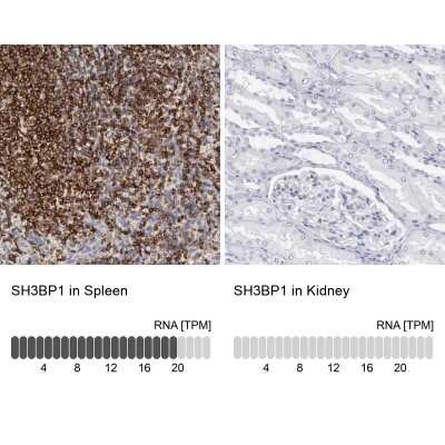 Immunohistochemistry-Paraffin: SH3BP1 Antibody [NBP1-88827] - Staining in human spleen and kidney tissues using anti-SH3BP1 antibody. Corresponding SH3BP1 RNA-seq data are presented for the same tissues.