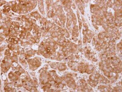 Immunohistochemistry-Paraffin: SH3BP1 Antibody [NBP2-20342] - Paraffin-embedded MDA-MB-157 tumor xenograft. SH3BP1 antibody dilution: 1:250.