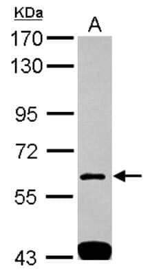 Western Blot: SH3BP1 Antibody [NBP2-20342] - Sample (30 ug of whole cell lysate) A: A431 7. 5% SDS PAGE gel, diluted at 1:1000.