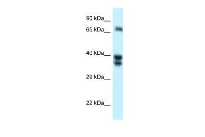 Western Blot: SH3BP1 Antibody [NBP2-88259] - WB Suggested Anti-SH3BP1 Antibody. Titration: 1.0 ug/ml. Positive Control: 721_B Whole CellSH3BP1 is supported by BioGPS gene expression data to be expressed in 721_B