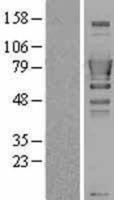 Western Blot: SH3BP1 Overexpression Lysate (Adult Normal) [NBL1-15926] Left-Empty vector transfected control cell lysate (HEK293 cell lysate); Right -Over-expression Lysate for SH3BP1.