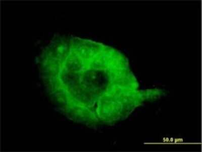 Immunocytochemistry/Immunofluorescence: SH3BP2 Antibody (1E9) [H00006452-M01] - Analysis of monoclonal antibody to SH3BP2 on A-431 cell. Antibody concentration 20 ug/ml.