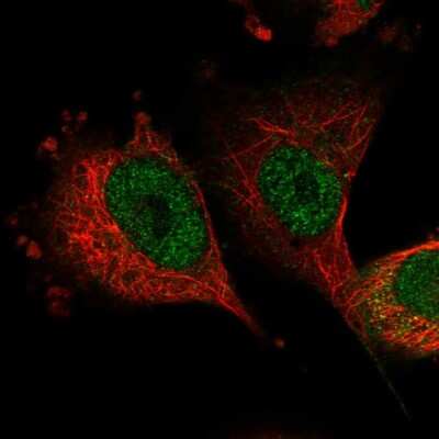 Immunocytochemistry/Immunofluorescence: SH3BP2 Antibody [NBP1-85458] - Immunofluorescent staining of human cell line U-251 MG shows localization to nucleoplasm.