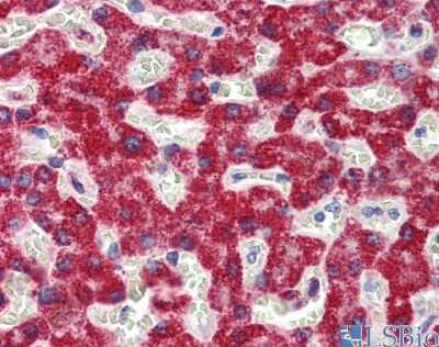 Immunohistochemistry: SH3BP2 Antibody [NBP1-58872] - Staining of human liver cross section.