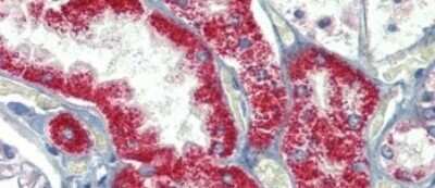 Immunohistochemistry-Paraffin: SH3BP2 Antibody [NBP1-58872] - Human kidney Tissue, antibody concentration  5 ug/ml.