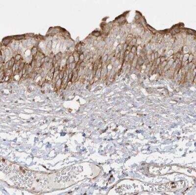 Immunohistochemistry-Paraffin: SH3BP2 Antibody [NBP1-85458] - Staining of human urinary bladder shows moderate cytoplasmic positivity in urothelial cells.
