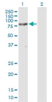 Western Blot: SH3BP2 Antibody [H00006452-B01P] - Analysis of SH3BP2 expression in transfected 293T cell line by SH3BP2 polyclonal antibody.  Lane 1: SH3BP2 transfected lysate(62.20 KDa). Lane 2: Non-transfected lysate.