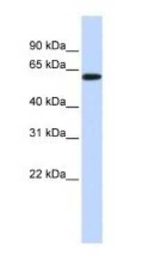 Western Blot SH3BP2 Antibody