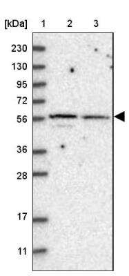 Western Blot SH3BP2 Antibody