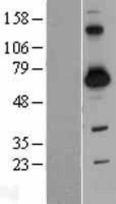 Western Blot SH3BP2 Overexpression Lysate