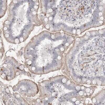 Immunohistochemistry-Paraffin: SH3BP4 Antibody [NBP2-38352] - Staining of human small intestine shows membranous positivity in glandular cells.