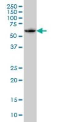 Western Blot: SH3BP5 Antibody (2B3) [H00009467-M01] - SH3BP5 monoclonal antibody (M01), clone 2B3 Analysis of SH3BP5 expression in A-431.