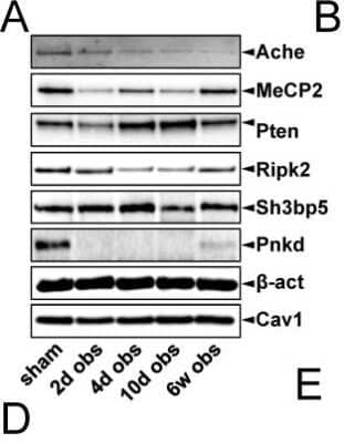 Western Blot: SH3BP5 Antibody (2B3) [H00009467-M01] - Reduced levels of the miR-132/212 targets Ache, MeCp2 and Pnkd in the bladder following outlet obstruction.Validated targets of miR-132/212 (including SH3BP5) were examined at the protein level using western blotting at various times after surgical obstruction of the urethra. Image collected and cropped by CiteAb from the following publication (//dx.plos.org/10.1371/journal.pone.0116784) licensed under a CC-BY license.